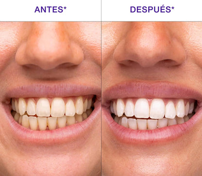 ¡Blanquea Tus Dientes Sensibles en Solo 7 Días Sin Dolor ni Peróxido!