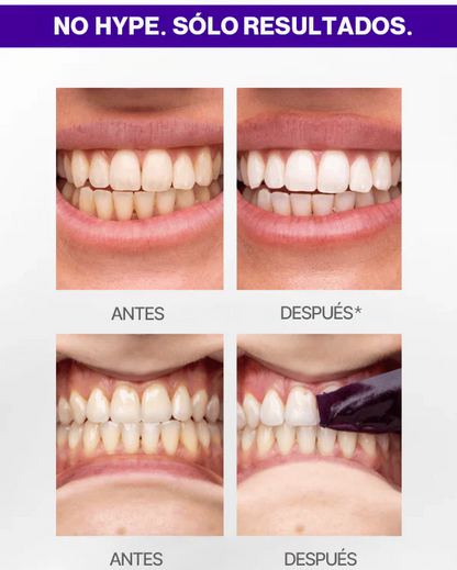 ¡Blanquea Tus Dientes Sensibles en Solo 7 Días Sin Dolor ni Peróxido!